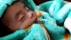Death Stalks 1 Million Afghan Children Facing Malnutrition